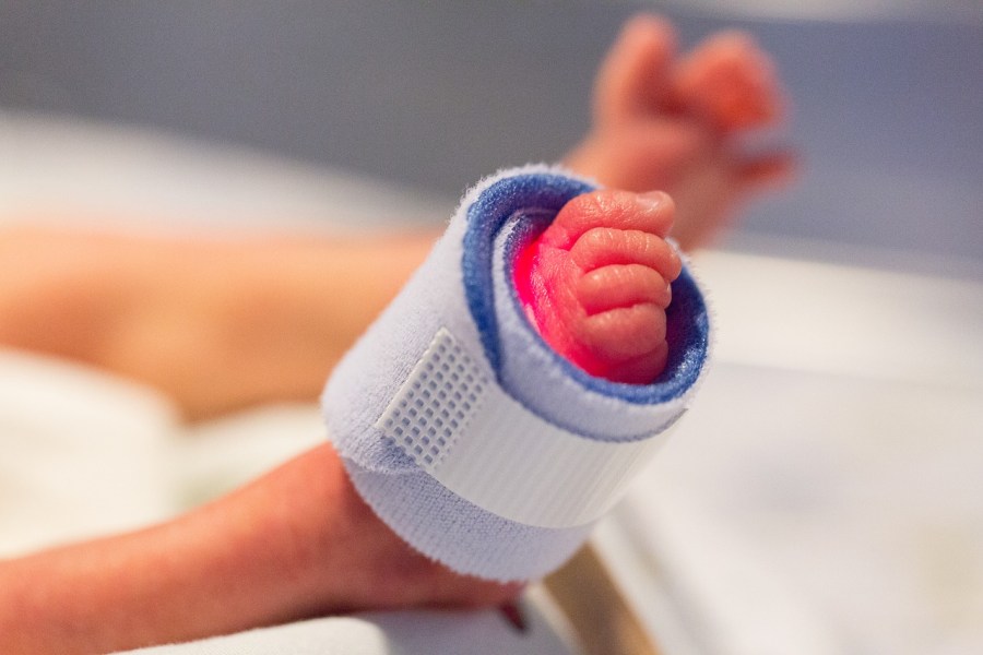 A baby's foot hooked up to a machine