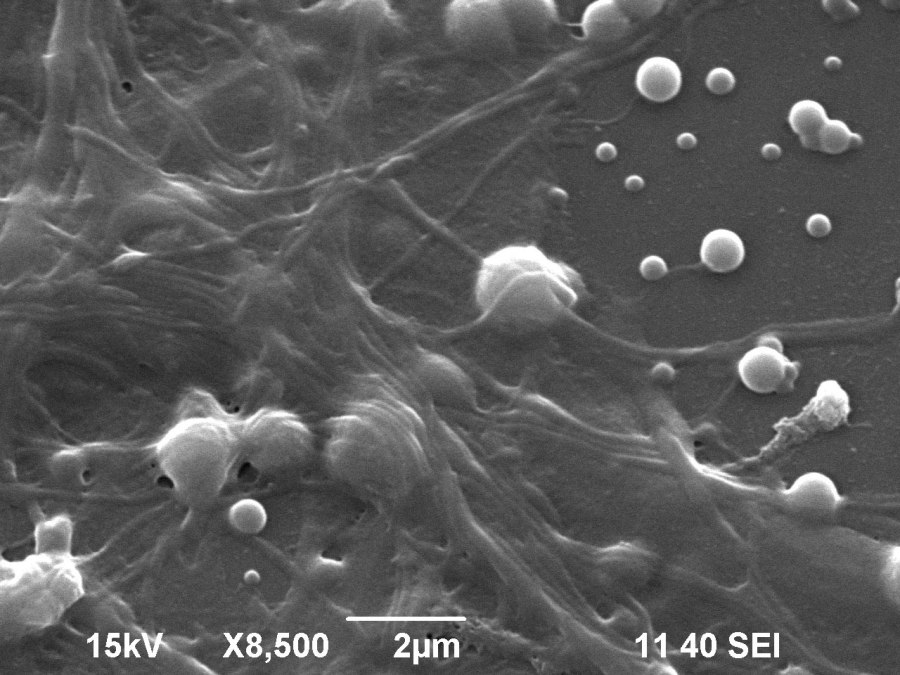 Scanning electron microscopy image showing detail of the neural network on a layer of nanoparticles.