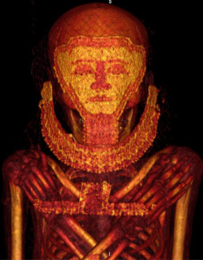 TAC momia egipcia