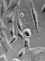Apoptosis en SMC: microscopía óptica invertida de 
SMC-Ch en cultivo incubadas durante 8 horas con 
0,6 mM de nitroprusiato.
