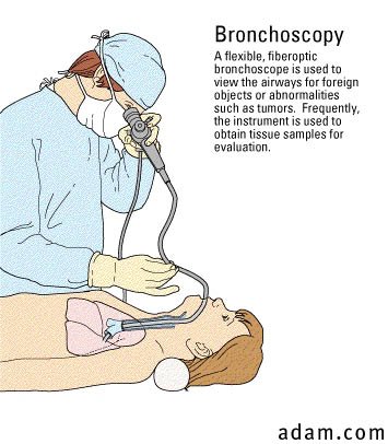Bronchoscope.jpg