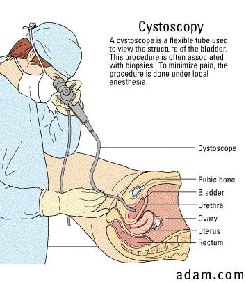 cystoscopy1089.jpg