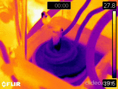 Hyperthermia
