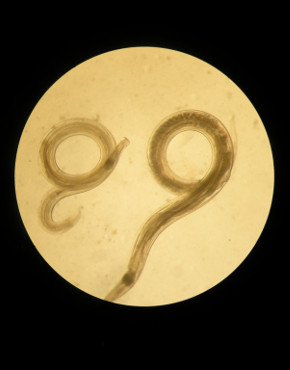 muestra al microscopio