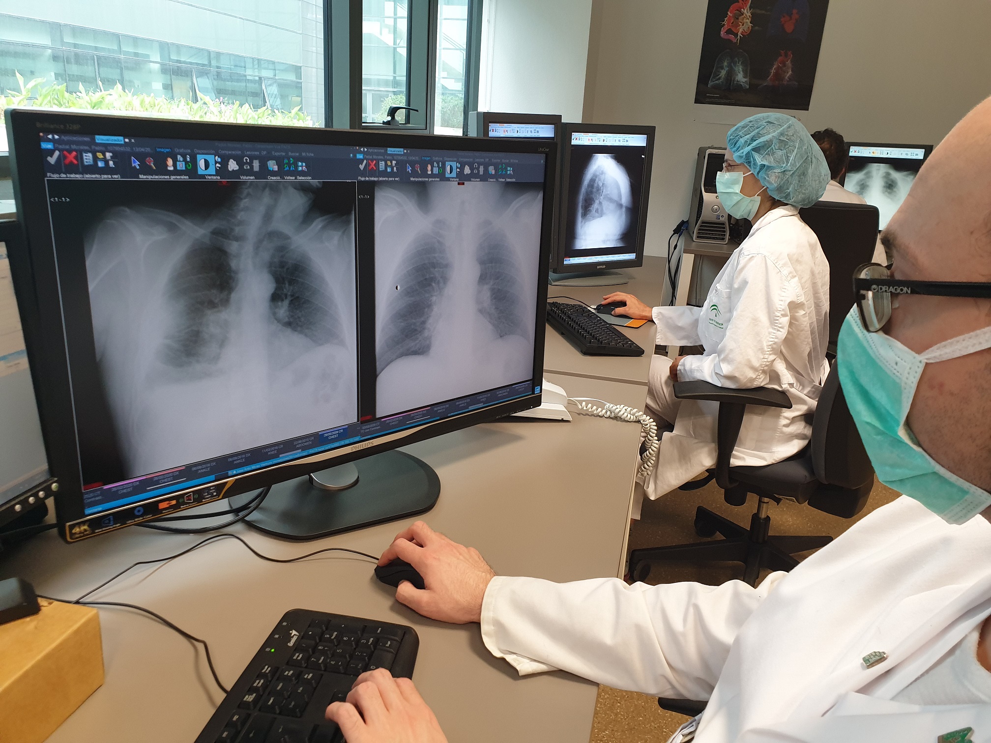 Médico analizando radiografías de tórax con este sistema de I.A.
