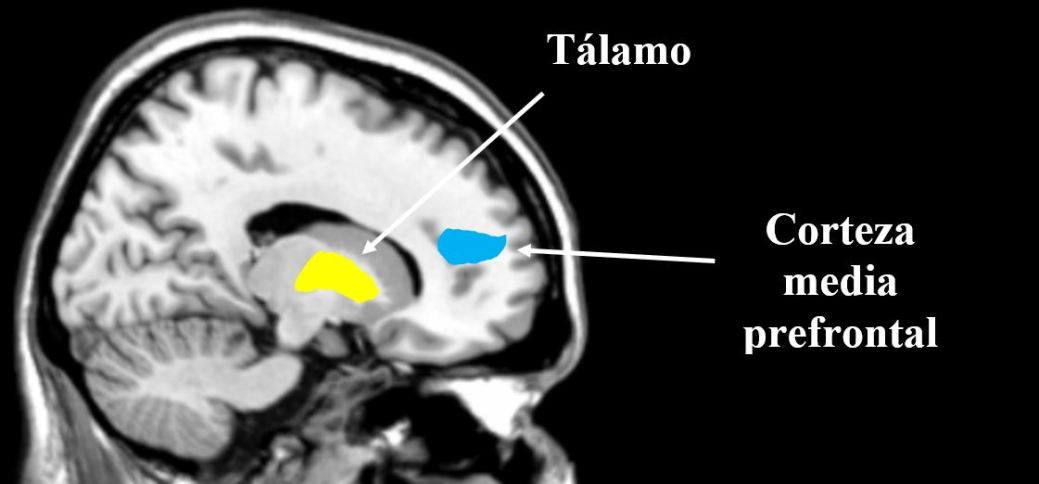 A brain scan