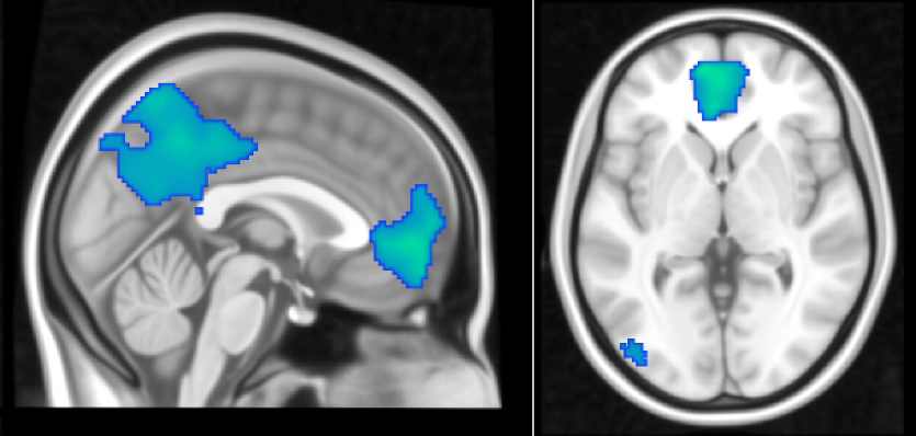 Musicians Brain Activity