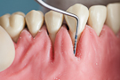 material_dental