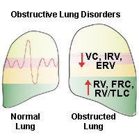 Obstructive Vs Restrictive Lung Disease Chart